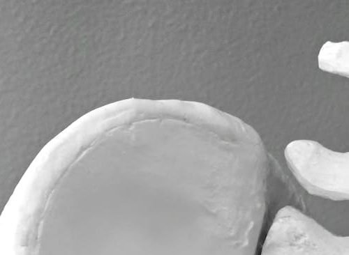 The Hidden Link Between Pelvic Floor Dysfunction and Back Pain